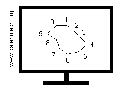 monitor con profilo bidimensionale