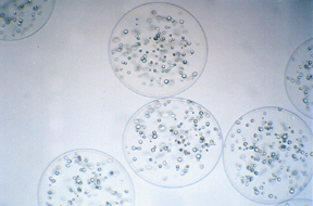 cellule microincapsulate